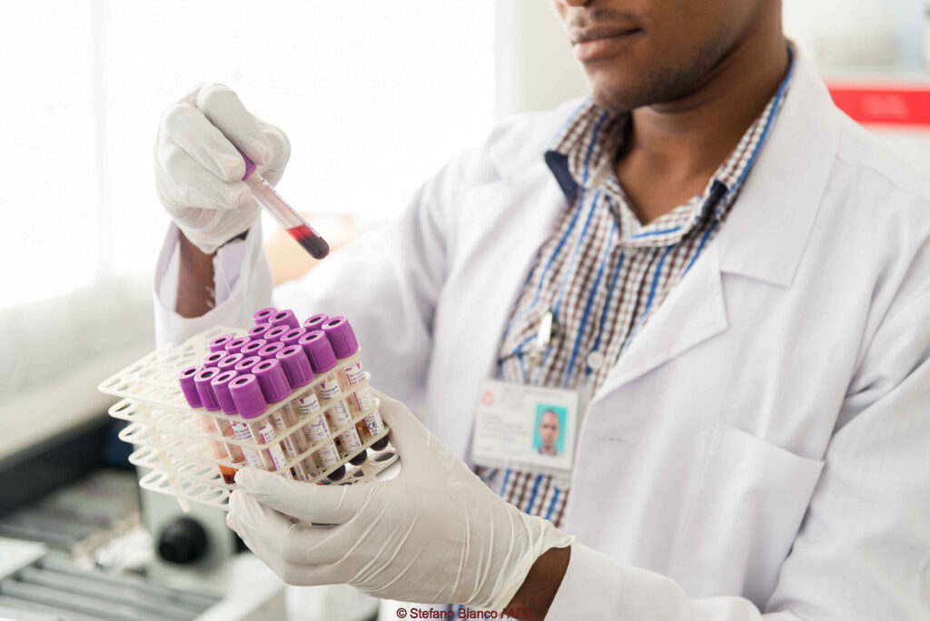 Laboratory Analysis In Ukonga Polyclinic.