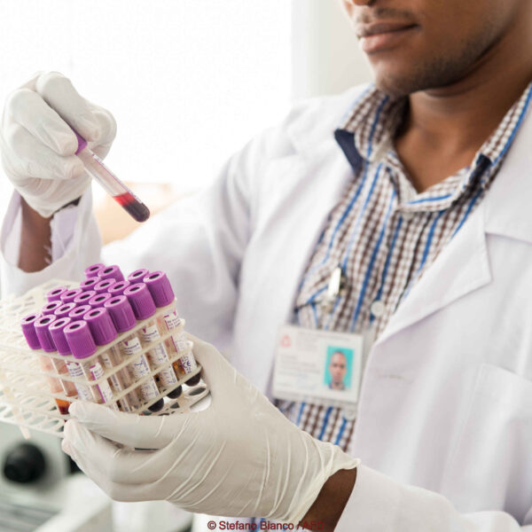 Laboratory Analysis In Ukonga Polyclinic.